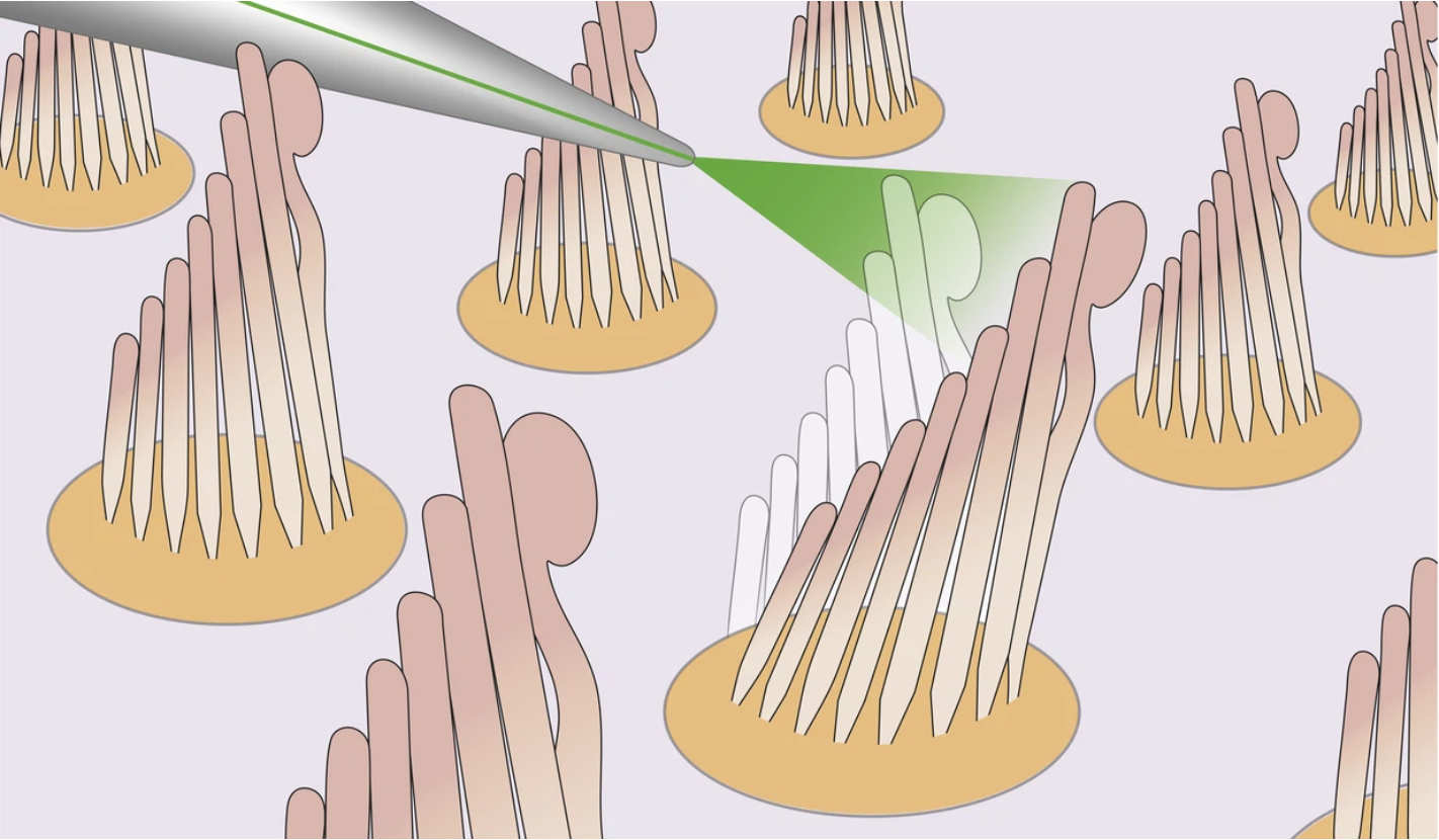 An illustration of the use of light stimulation to move hair bundles